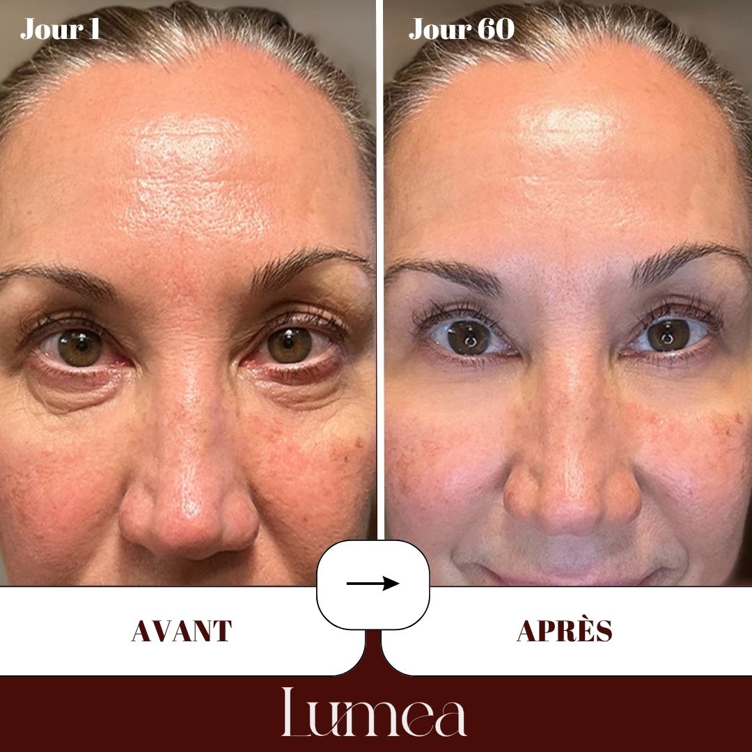Patchs yeux au collagène lyophilisé haute pureté