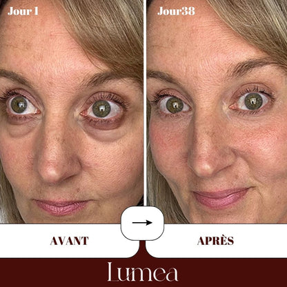 Patchs yeux au collagène lyophilisé haute pureté