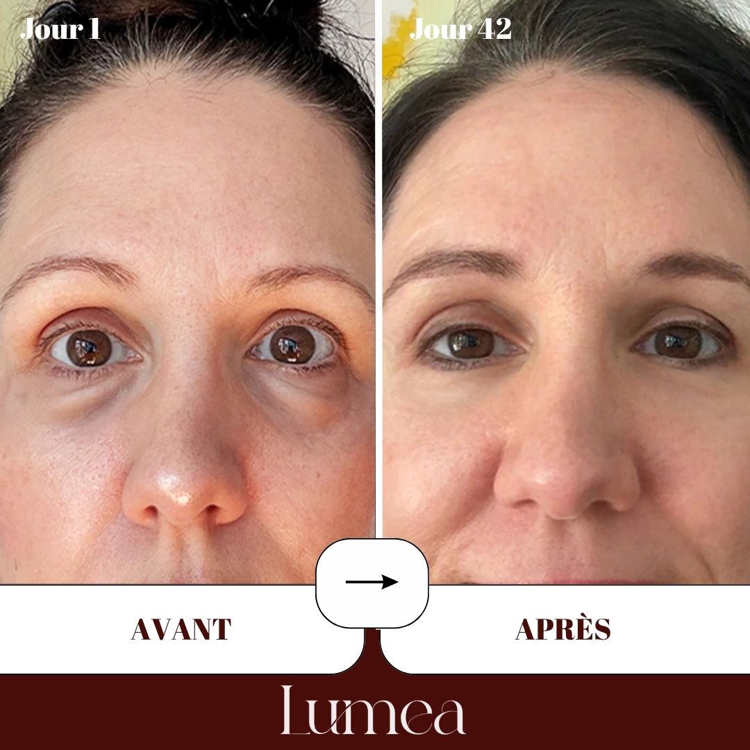 Patchs yeux au collagène lyophilisé haute pureté