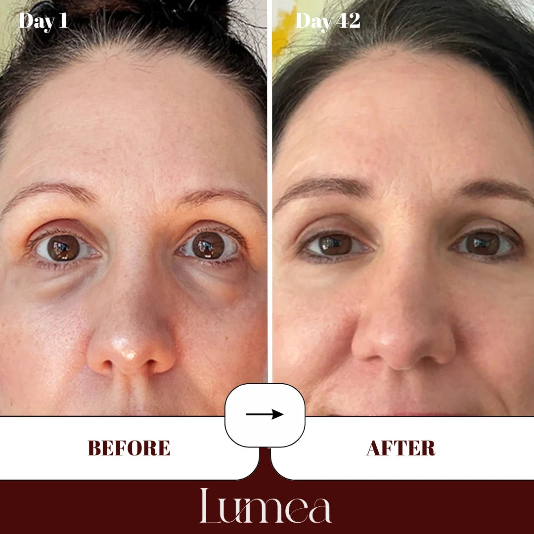 CryoSilk Eye Mask