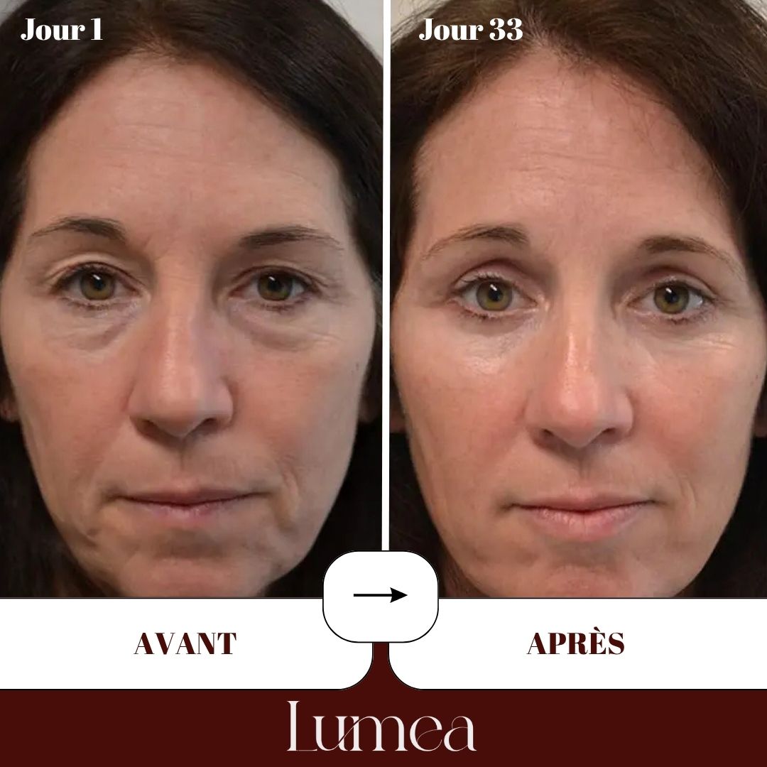Patchs yeux au collagène lyophilisé haute pureté