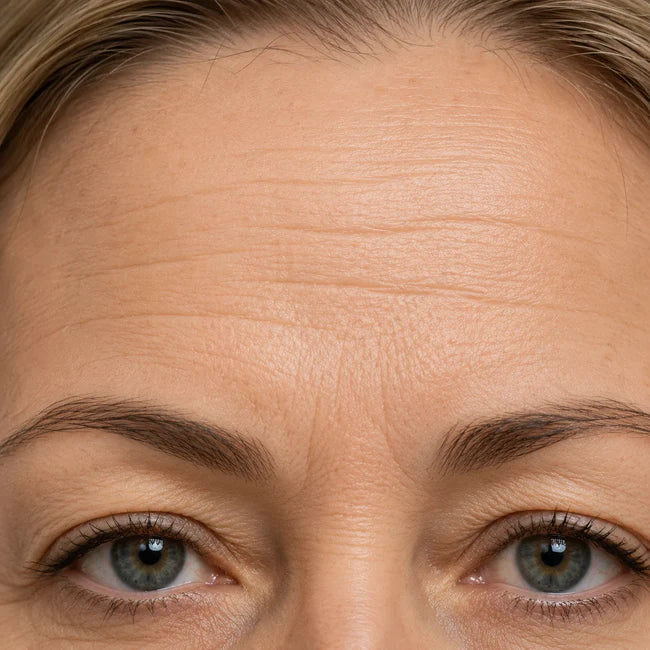 Forehead