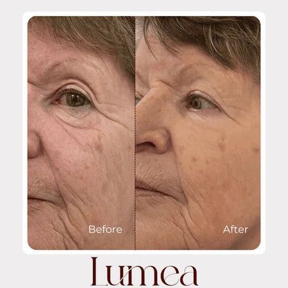 Before and after mature skin comparison showing improved-looking texture with Lumea skincare