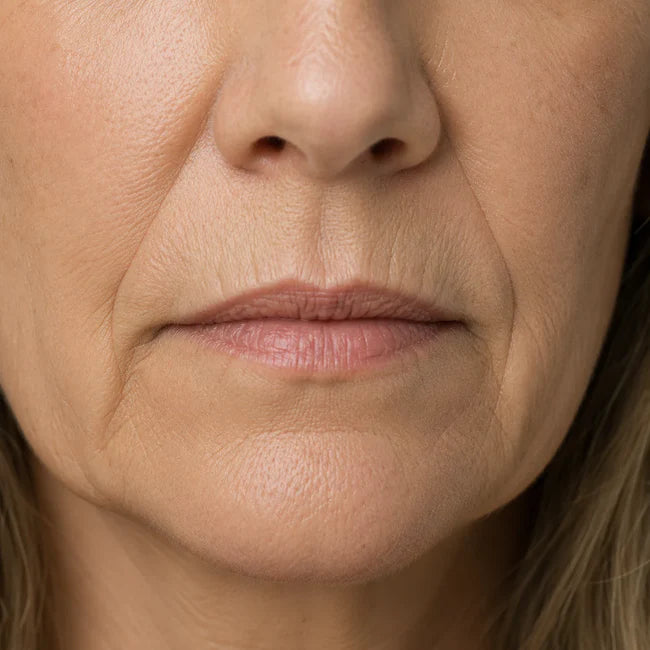 Mouth area